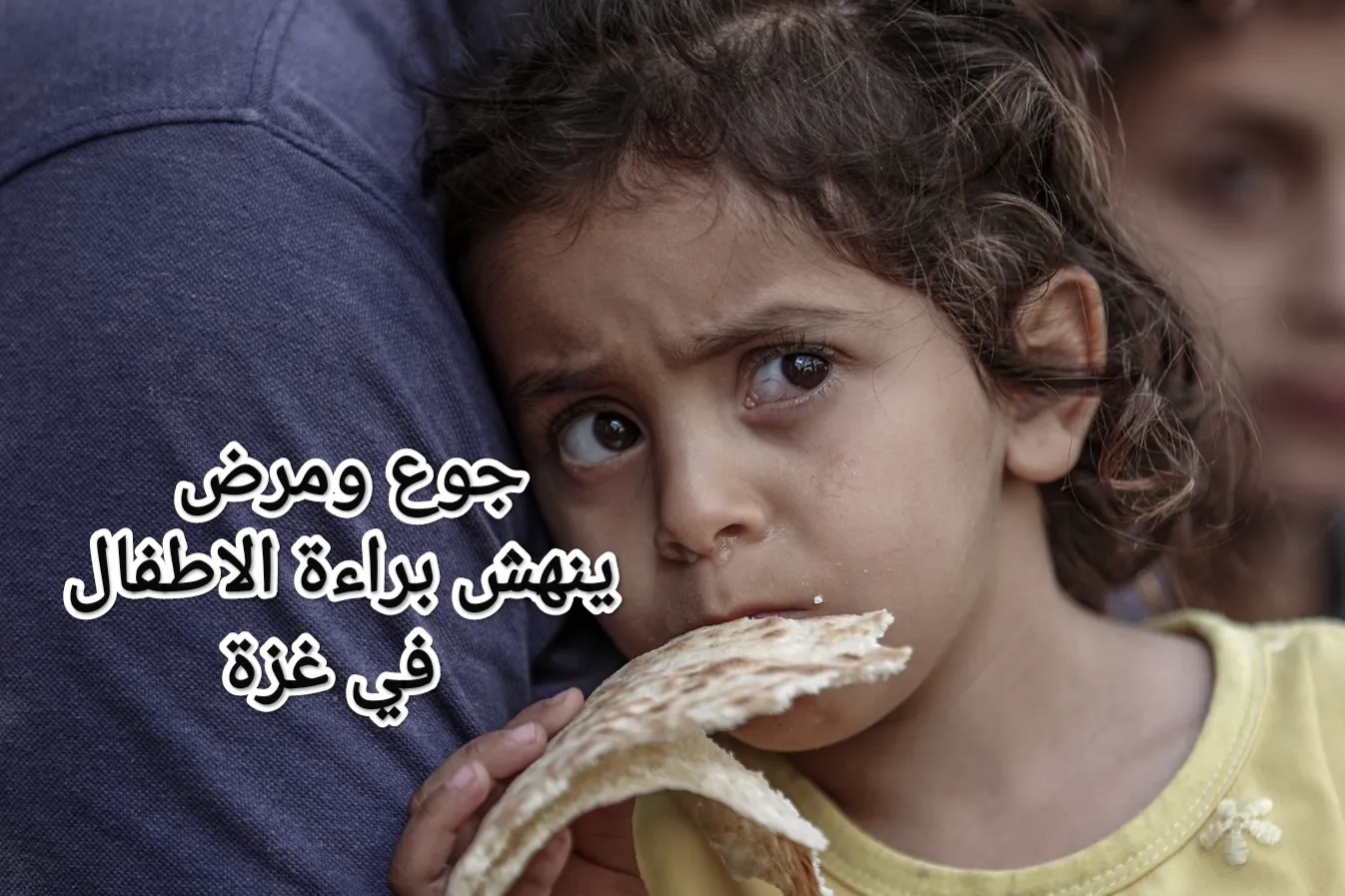 إعانة الاطفال المرضى في غزة